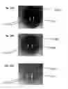 Fig. 10 - System and method for selecting follicular units for harvesting