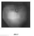 Fig. 11 - Interfacing media manipulation with non-ablation radiofrequency energy system and method