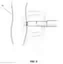 Fig. 13 - Interfacing media manipulation with non-ablation radiofrequency energy system and method