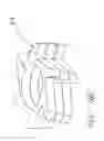 Fig. 06 - Disposable bone cutting instrument