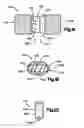Fig. 07 - Implant insertion apparatus and method of use