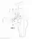Fig. 02 - Acetabular shell removal tool