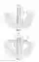 Fig. 03 - Acetabular shell removal tool