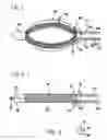 Fig. 02 - Breast surgery method and apparatus