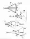 Fig. 07 - Breast surgery method and apparatus