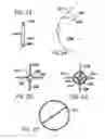 Fig. 08 - Breast surgery method and apparatus