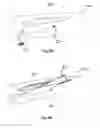 Fig. 06 - Microsurgery for Treatment of Glaucoma