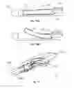 Fig. 07 - Microsurgery for Treatment of Glaucoma