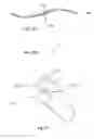 Fig. 08 - Microsurgery for Treatment of Glaucoma