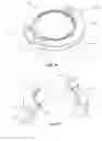 Fig. 09 - Microsurgery for Treatment of Glaucoma