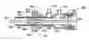 Fig. 01 - Balloon dissection apparatus