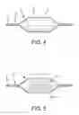 Fig. 04 - Non-shortening high angle wrapped balloons