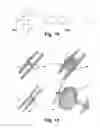 Fig. 06 - Occlusion Instruments Comprising Bioresorbable Radiopaque Polymeric Materials, As Well As Related Products, Methods And Uses