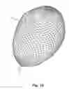 Fig. 08 - Occlusion Instruments Comprising Bioresorbable Radiopaque Polymeric Materials, As Well As Related Products, Methods And Uses