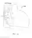 Fig. 02 - SYSTEMS DEVICES AND METHODS FOR ACHIEVING TRANSVERSE ORIENTATION IN THE TREATMENT OF SEPTAL DEFECTS