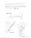 Fig. 16 - SYSTEMS DEVICES AND METHODS FOR ACHIEVING TRANSVERSE ORIENTATION IN THE TREATMENT OF SEPTAL DEFECTS