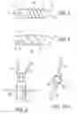 Fig. 02 - TWIST-IN SUTURE ANCHOR