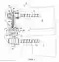 Fig. 02 - Systems and devices for dynamic stabilization of the spine