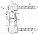 Fig. 01 - Systems and devices for dynamic stabilization of the spine