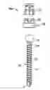 Fig. 01 - Posterior pedicle screw having a taper lock