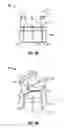 Fig. 04 - Posterior pedicle screw having a taper lock