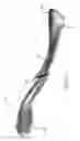 Fig. 06 - Clavicle nail with locking end cap
