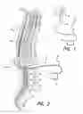 Fig. 02 - Neural stimulation system providing auto adjustment of stimulus output as a function of sensed impedance