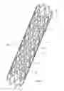 Fig. 02 - Automated stent coating apparatus and method