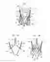 Fig. 02 - Sinus-engaging valve fixation member