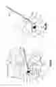 Fig. 11 - Minimally invasive spine augmentation and stabilization system and method