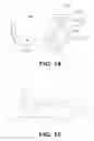 Fig. 09 - Spine distraction implant