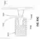 Fig. 49 - Spine distraction implant