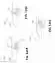Fig. 72 - Spine distraction implant