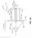 Fig. 85 - Spine distraction implant