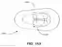 Fig. 98 - Spine distraction implant