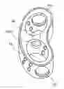 Fig. 01 - Intervertebral spacer