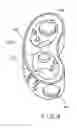 Fig. 09 - Intervertebral spacer