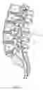 Fig. 02 - Spinal implant having a post-operative adjustable dimension
