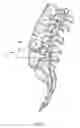 Fig. 04 - Spinal implant having a post-operative adjustable dimension