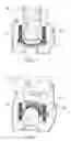 Fig. 08 - Spinal implant having a post-operative adjustable dimension