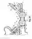 Fig. 20 - Spinal system and method including lateral approach
