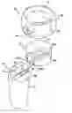 Fig. 01 - Modular prosthesis and use thereof for replacing a radial head
