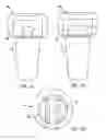 Fig. 06 - Modular prosthesis and use thereof for replacing a radial head