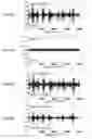 Fig. 31 - Noise suppression device and noise suppression method