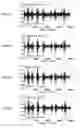 Fig. 32 - Noise suppression device and noise suppression method