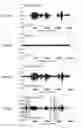 Fig. 33 - Noise suppression device and noise suppression method