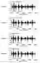 Fig. 36 - Noise suppression device and noise suppression method