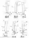 Fig. 03 - Forefoot wedge insert for footwear