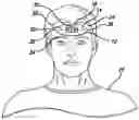 Fig. 01 - Forehead adhesive display