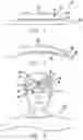 Fig. 02 - Forehead adhesive display